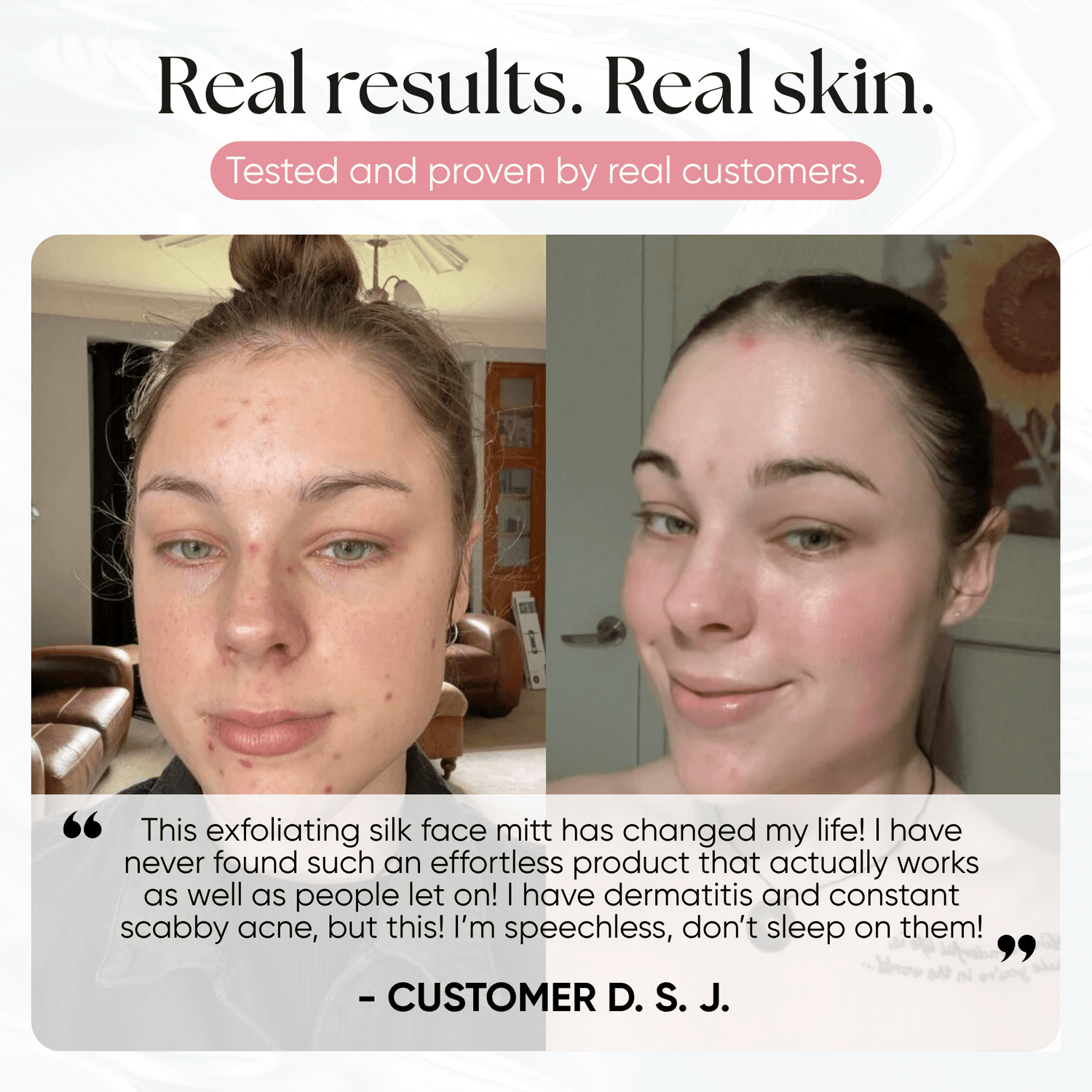CheekyGlo Silk Exfoliating Face Mitt - CHEEKYGLO