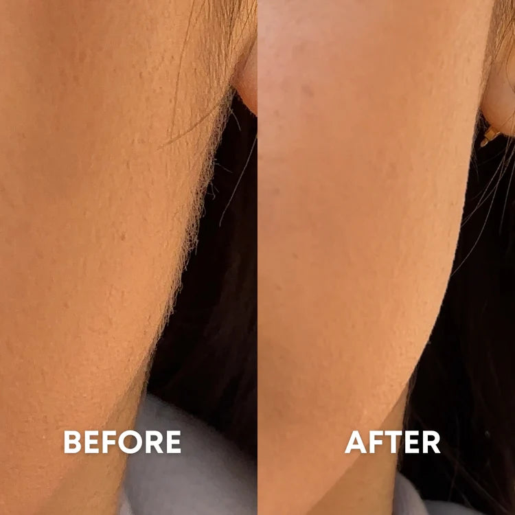 before and after results showing how cheekyglo dermablades removes facial hair and peach fuzz to achieve a smooth base