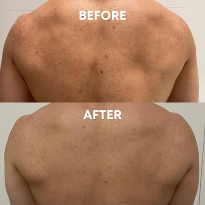 Everyday Essentials Set - CHEEKYGLO