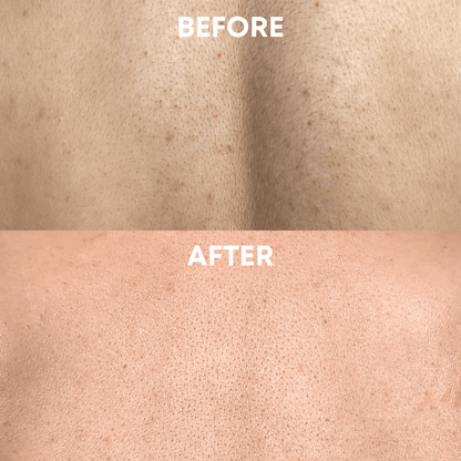 Exfoliating Body Duo - CHEEKYGLO