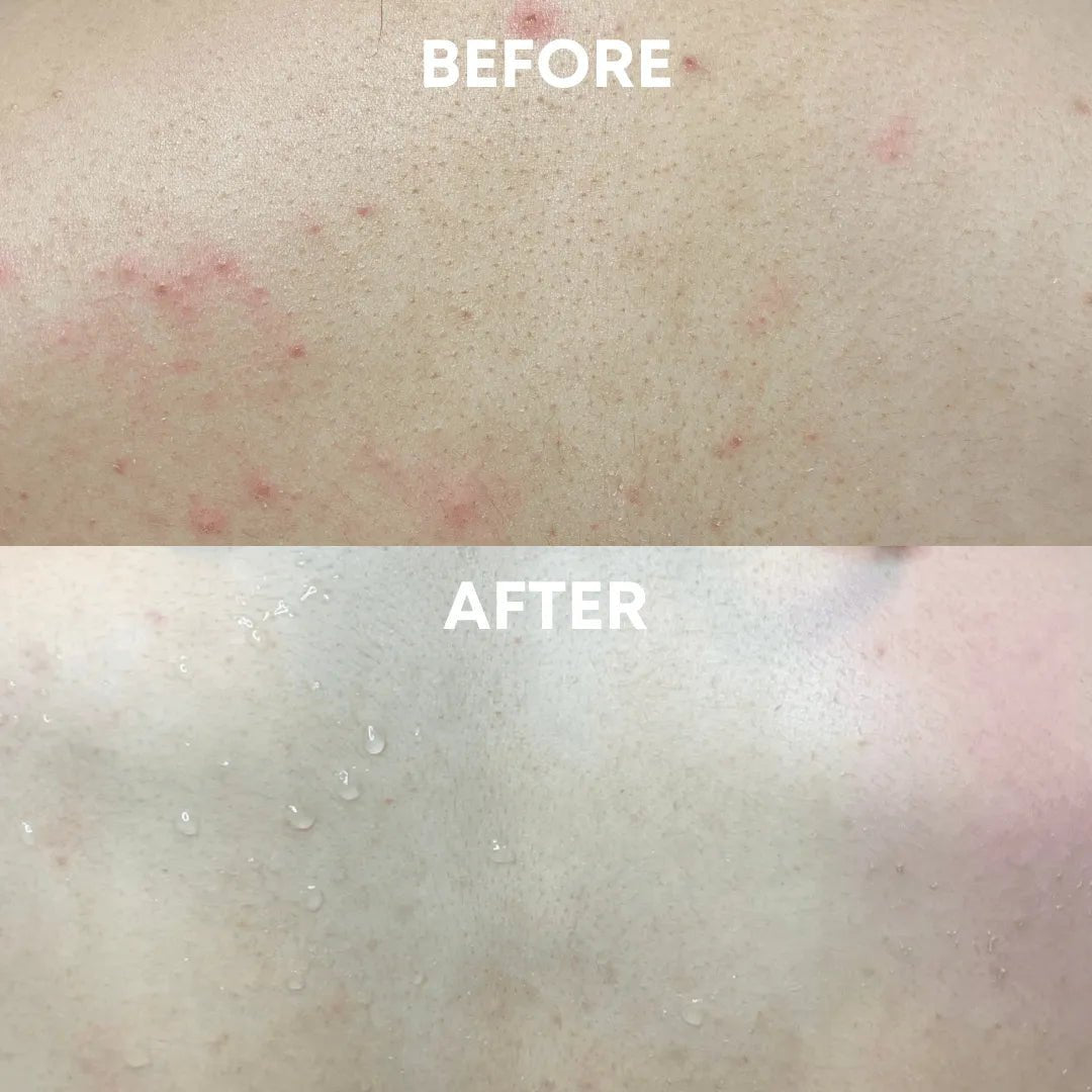 Exfoliating Body Duo - CHEEKYGLO