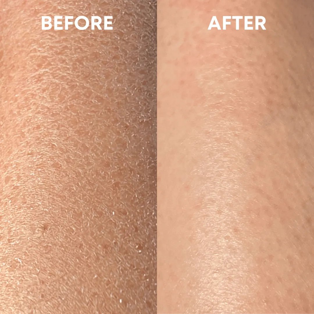 Exfoliating Body Duo - CHEEKYGLO