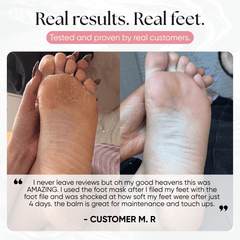Exfoliating Foot Peeling Mask (2 Pack) - CHEEKYGLO
