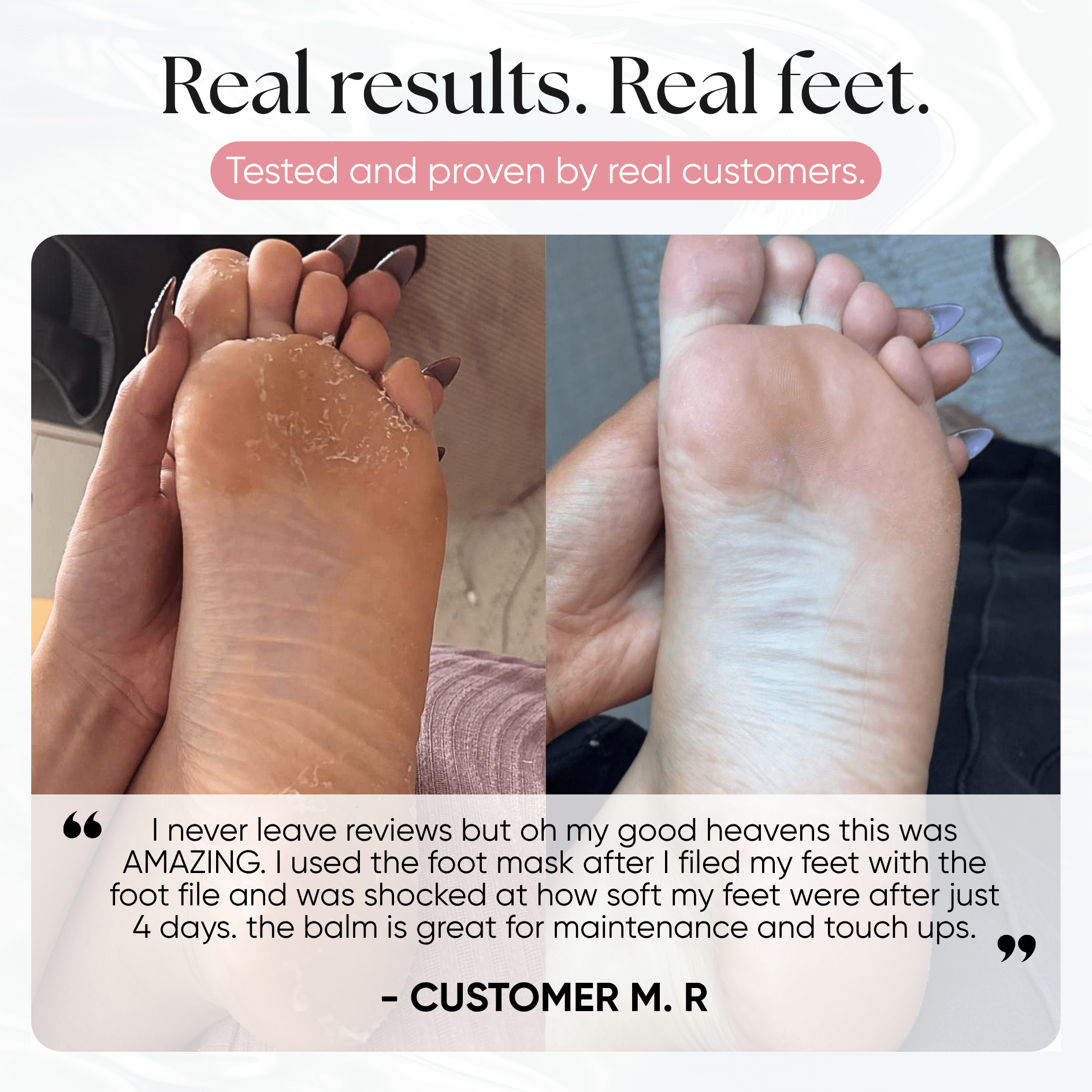 Exfoliating Foot Peeling Mask (2 Pack) - CHEEKYGLO