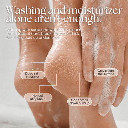 Exfoliating Foot Peeling Mask (2 Pack) - CHEEKYGLO