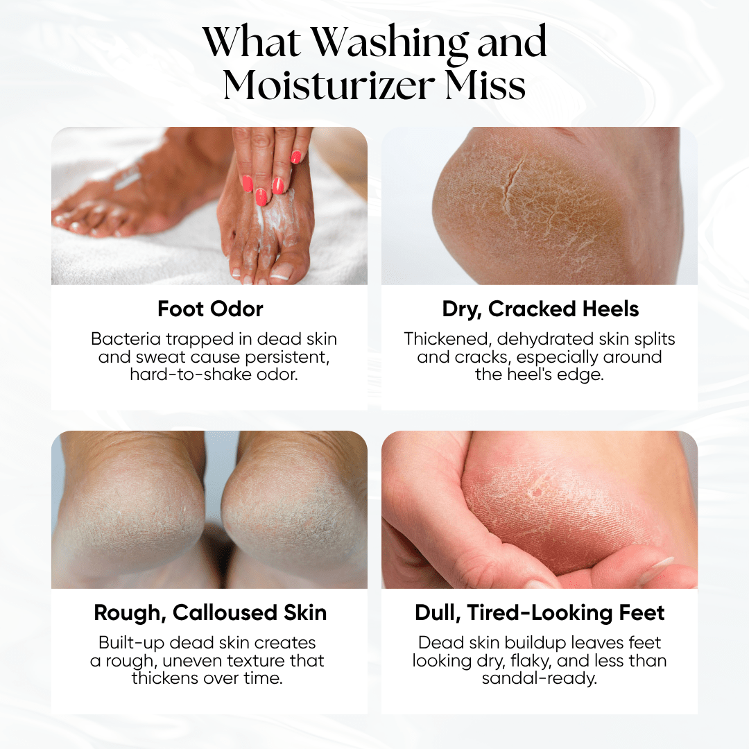Exfoliating Foot Peeling Mask (2 Pack) - CHEEKYGLO