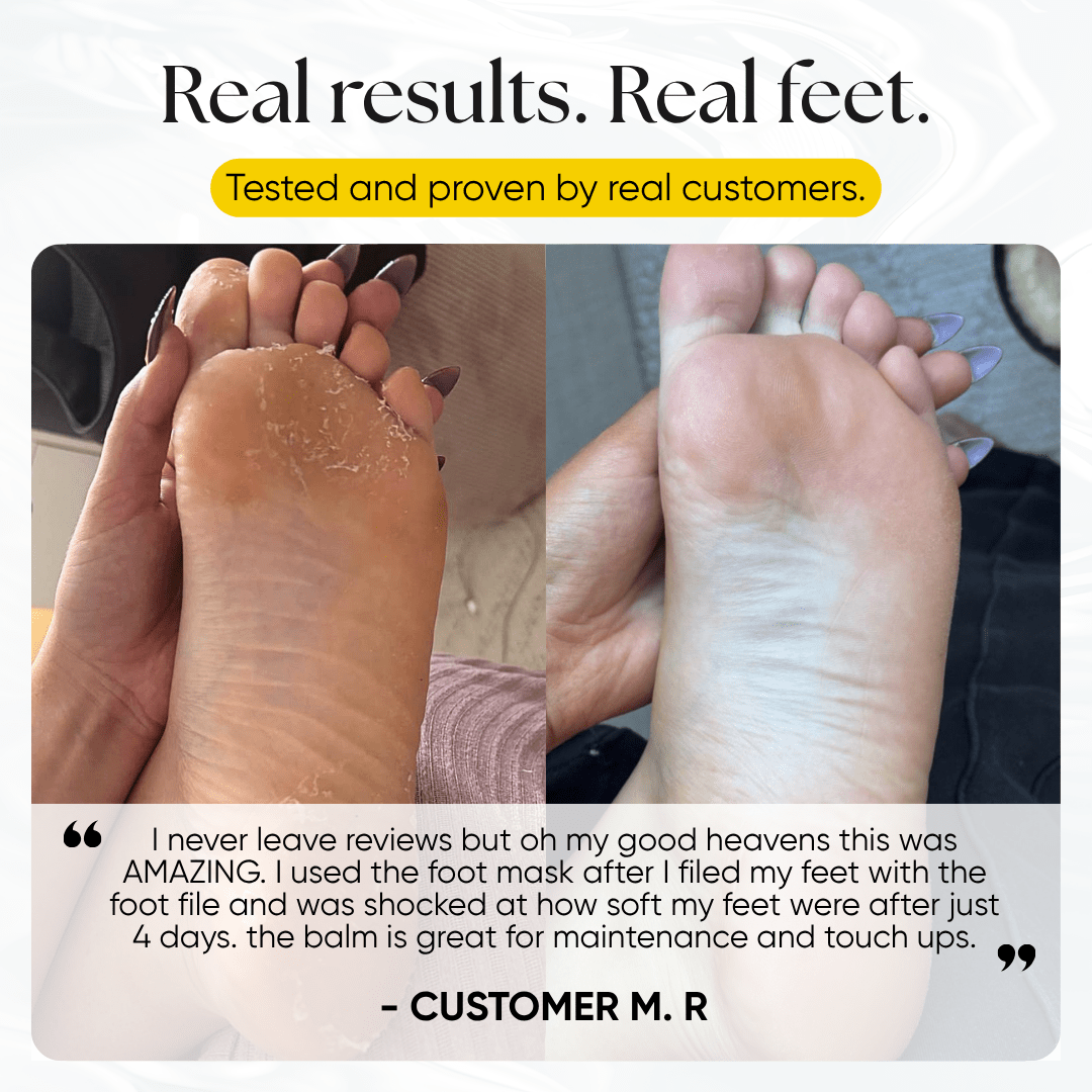 Exfoliating Foot Peeling Mask (2 Pack) - CHEEKYGLO