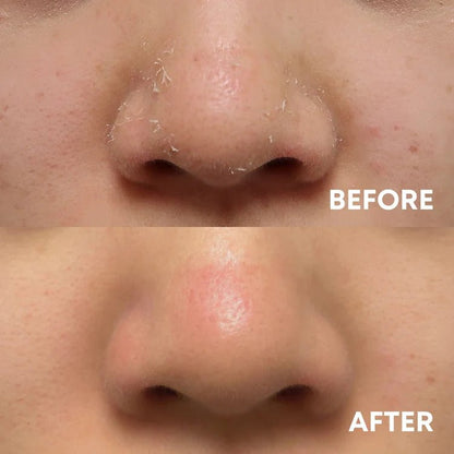 Exfoliating Trio - CHEEKYGLO