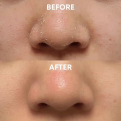 Face+Body Exfoliating Duo - CHEEKYGLO