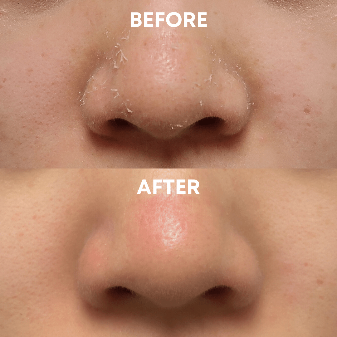 Face+Body Exfoliating Duo - CHEEKYGLO