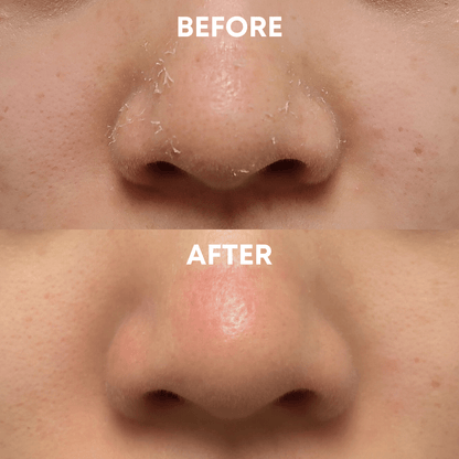 Face+Body Exfoliating Duo - CHEEKYGLO