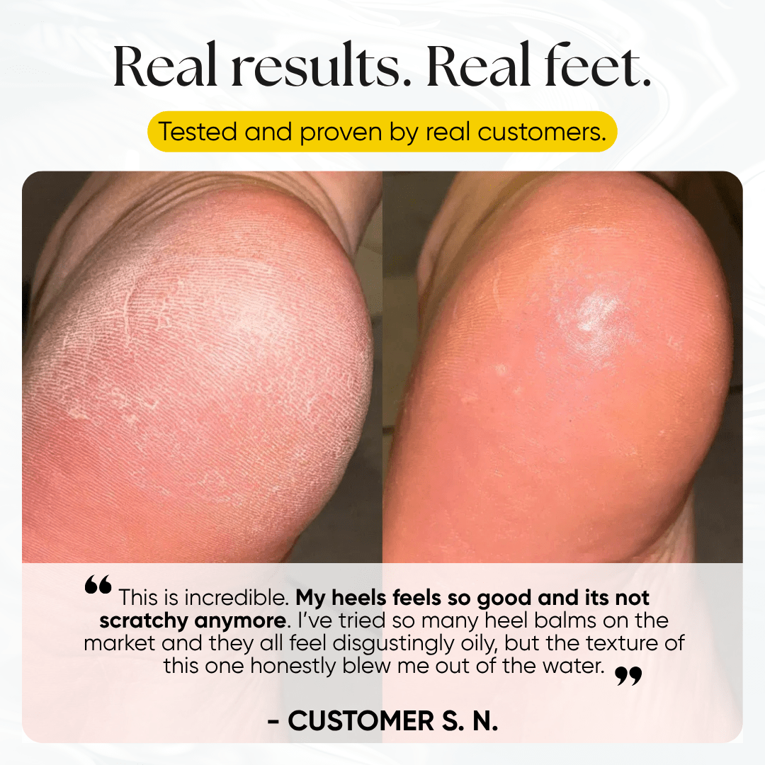 Foot Balm - CHEEKYGLO