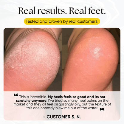 Foot Balm - CHEEKYGLO
