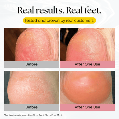 Foot Balm - CHEEKYGLO