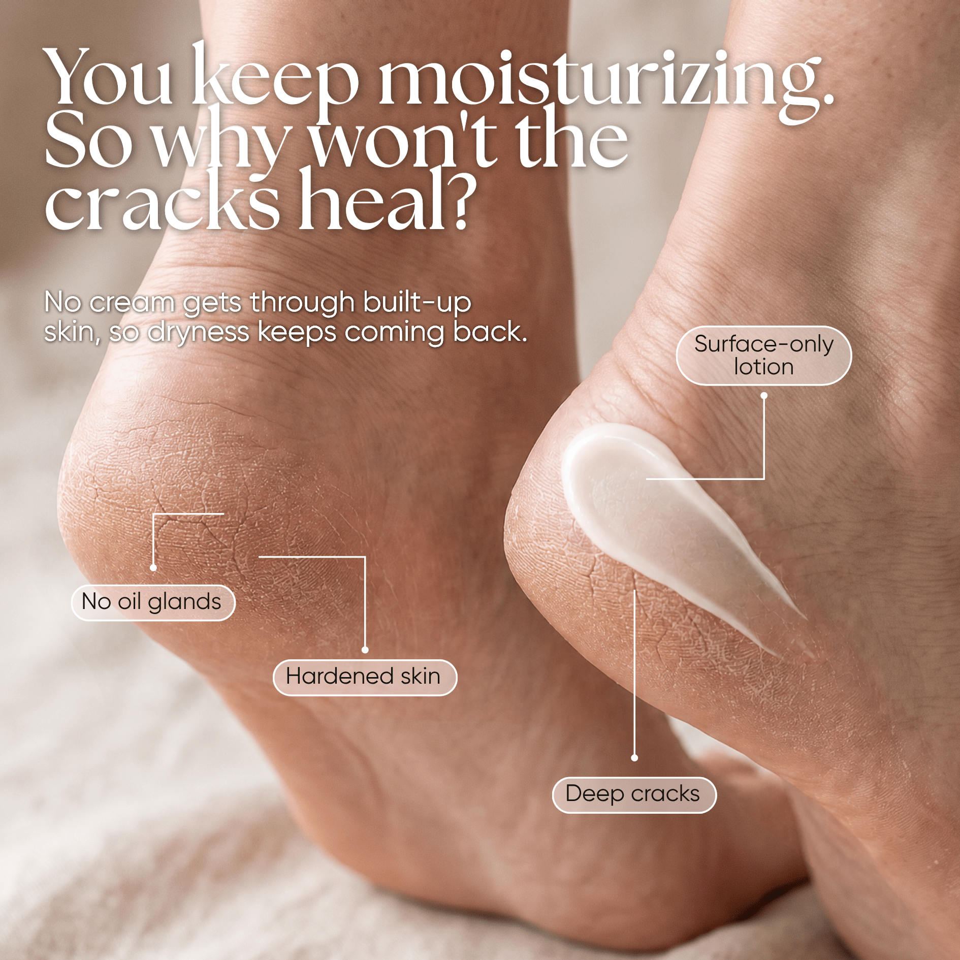 Foot Balm - CHEEKYGLO