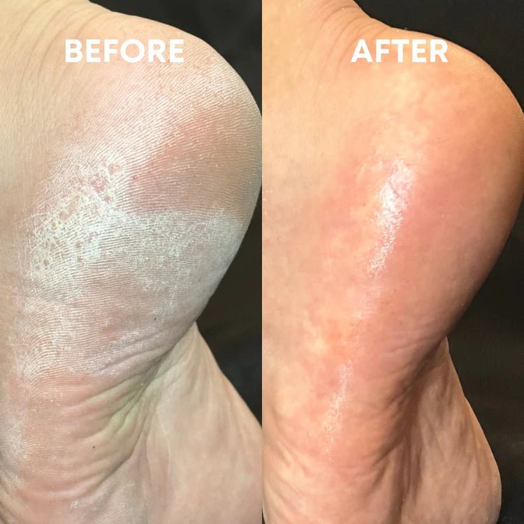 Foot Balm - CHEEKYGLO