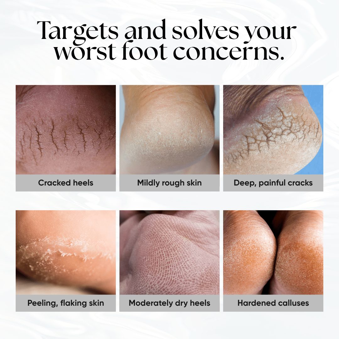 Foot Balm - CHEEKYGLO