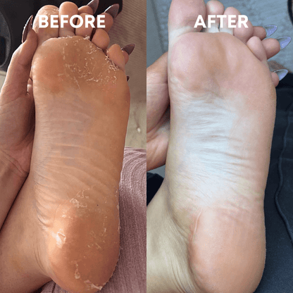 Foot Reset Bundle - CHEEKYGLO