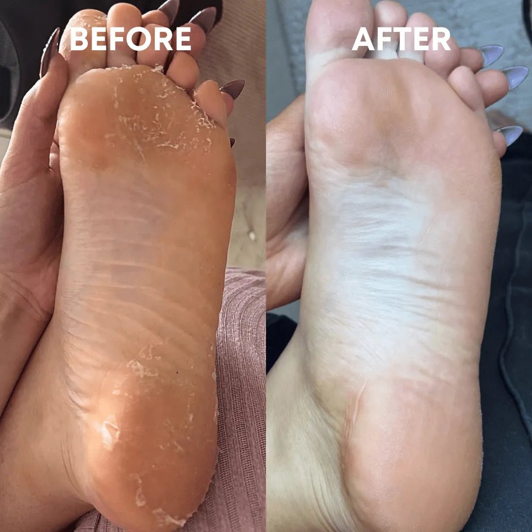 Foot Reset Bundle - CHEEKYGLO