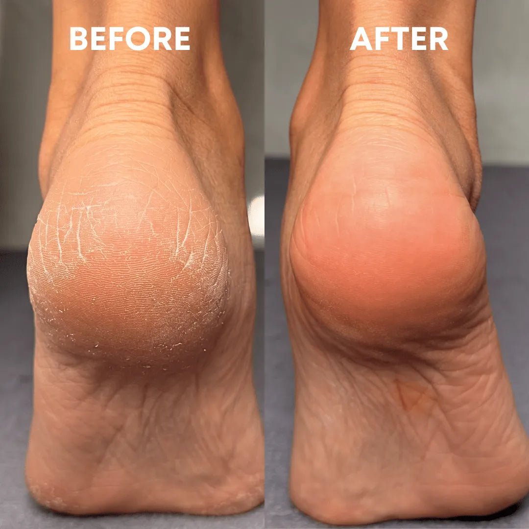 Foot Reset Bundle - CHEEKYGLO