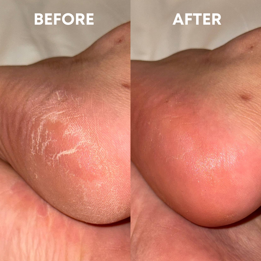 Dry heel recovery