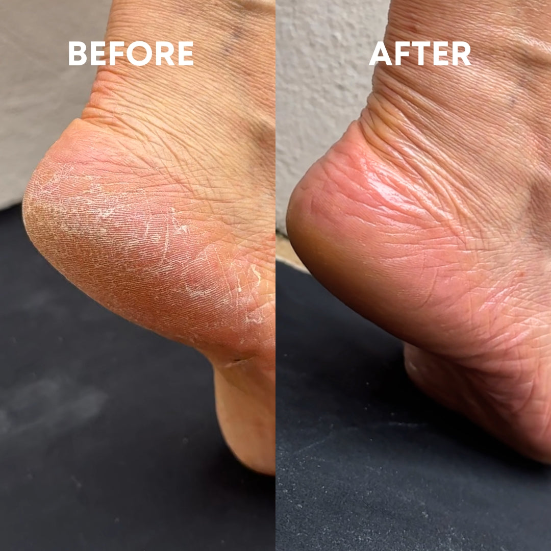 before and after using the cheekyglo glass foot file on cracked dry heels 
