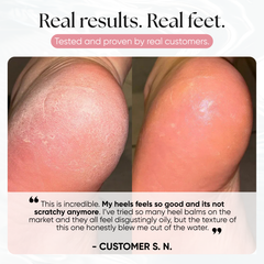 Foot Balm