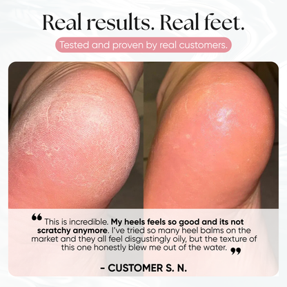 Foot Balm