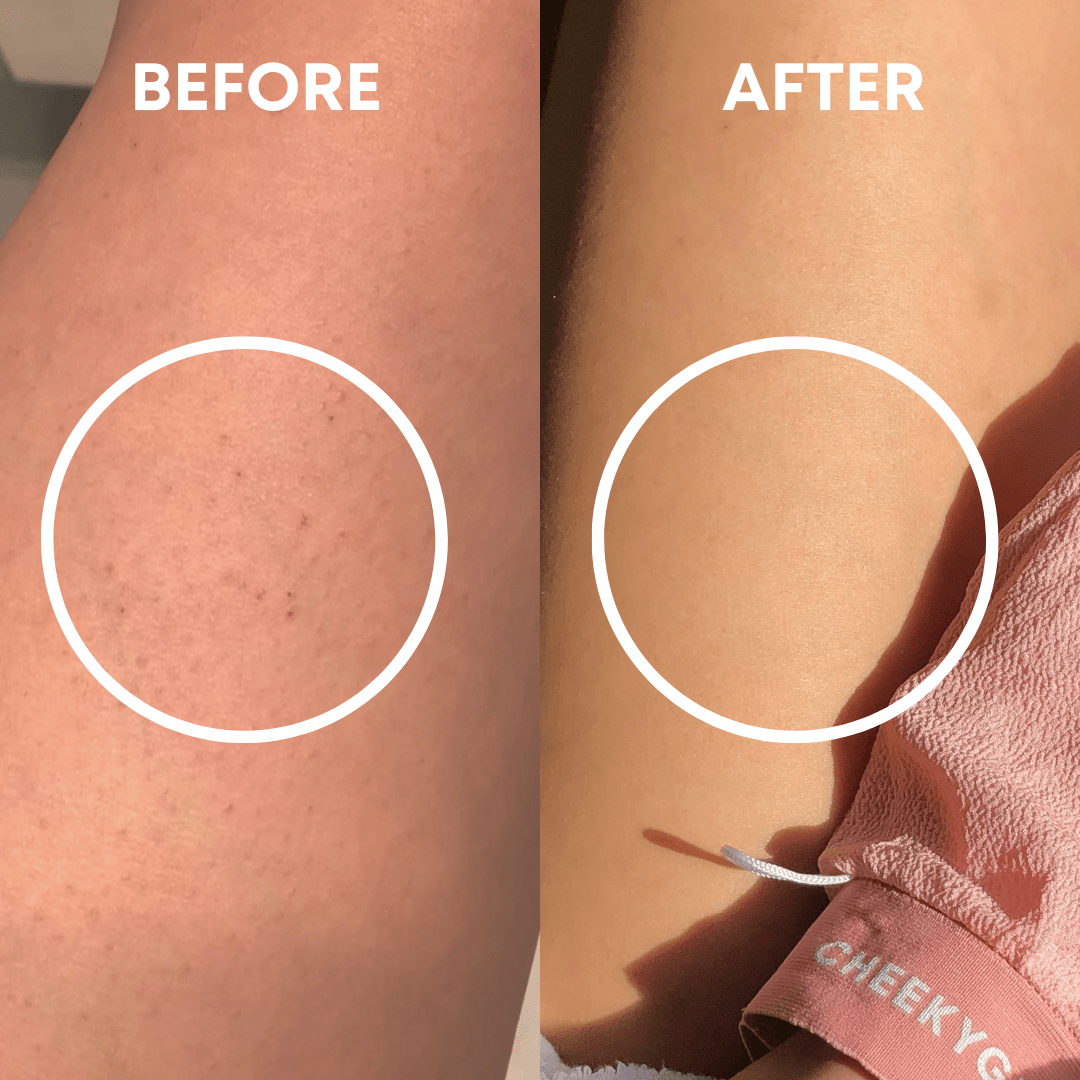 Glow Up Duo [MOST POPULAR] - CHEEKYGLO