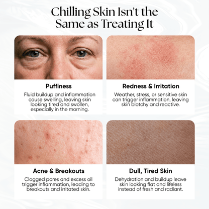 Ice Slushy Soothing Mask - CHEEKYGLO