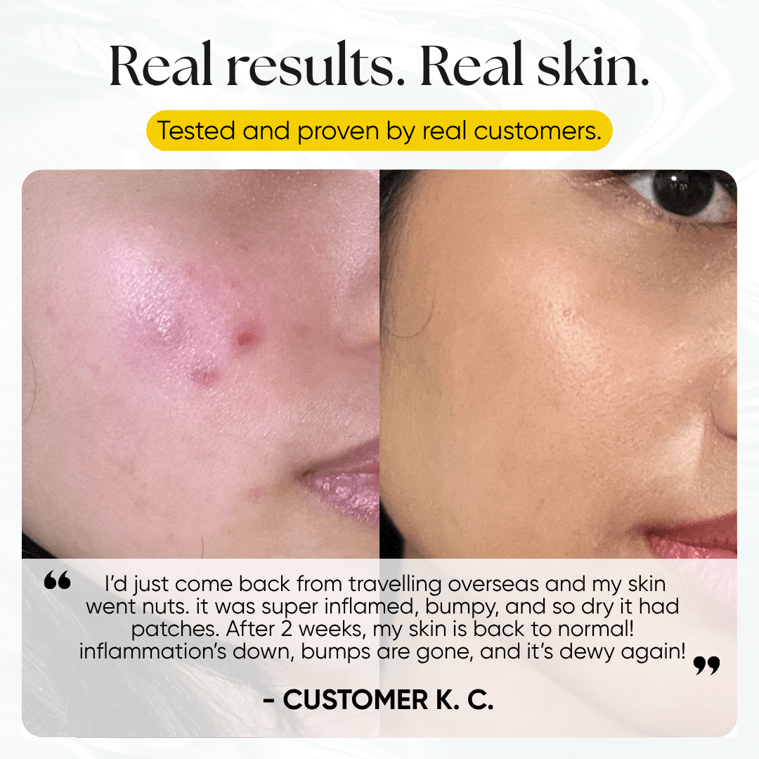 Ice Slushy Soothing Mask - CHEEKYGLO