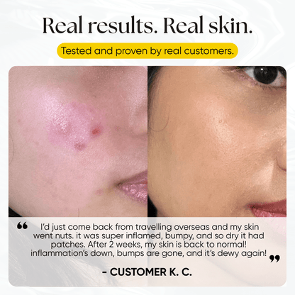 Ice Slushy Soothing Mask - CHEEKYGLO