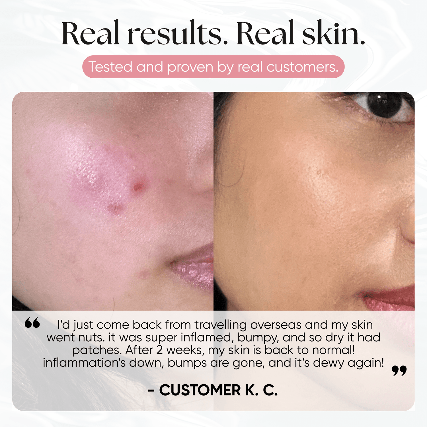 Ice Slushy Soothing Mask - CHEEKYGLO