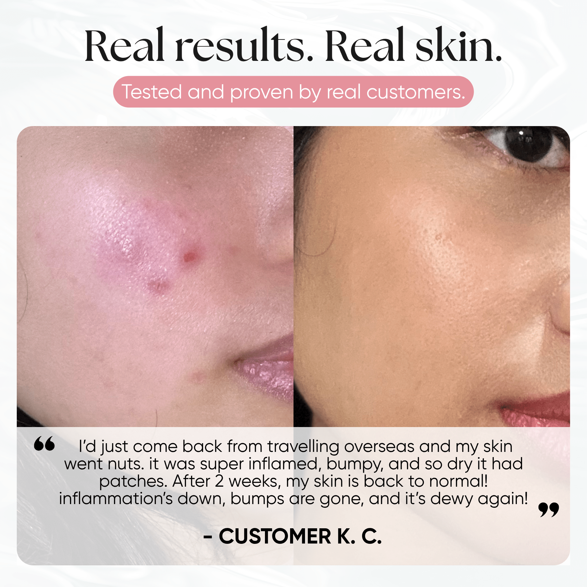 Ice Slushy Soothing Mask - CHEEKYGLO