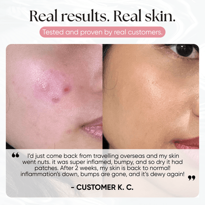 Ice Slushy Soothing Mask - CHEEKYGLO