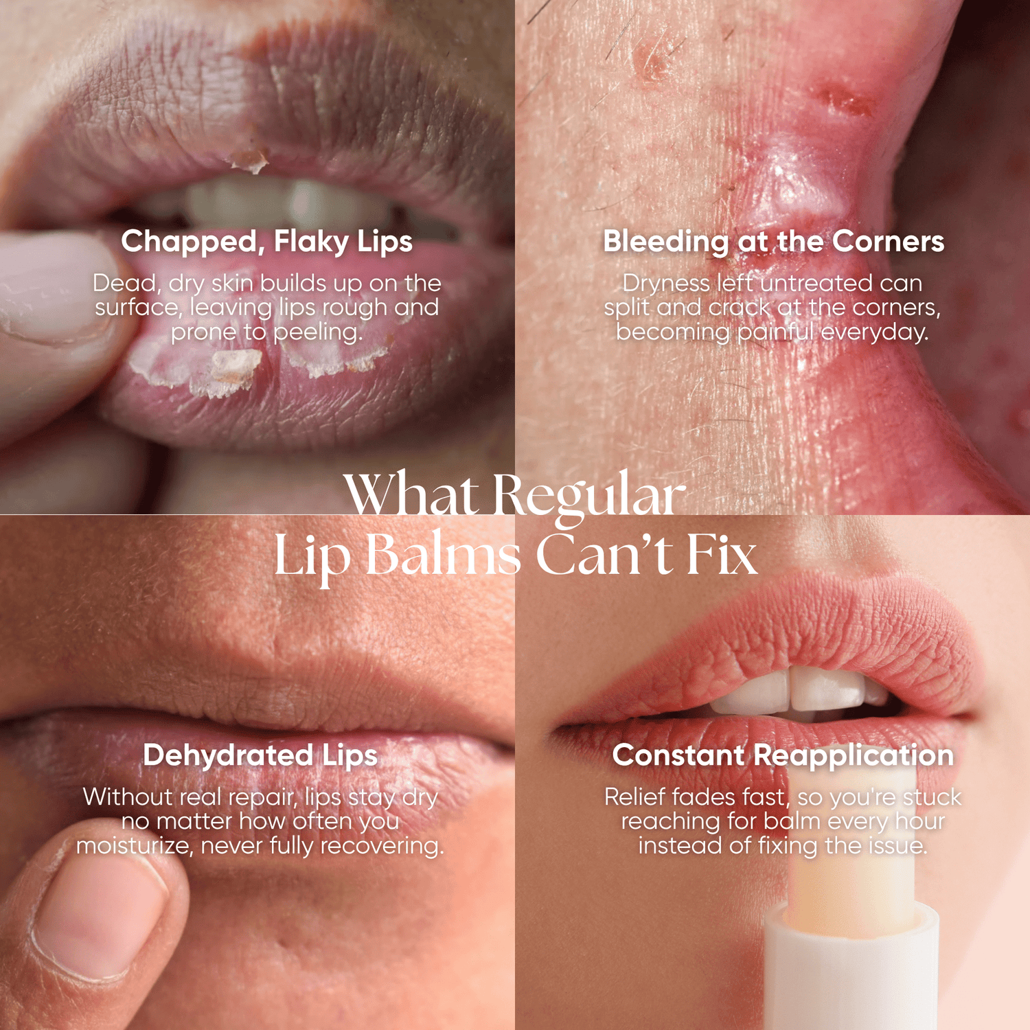 Lip Repair Essence - CHEEKYGLO