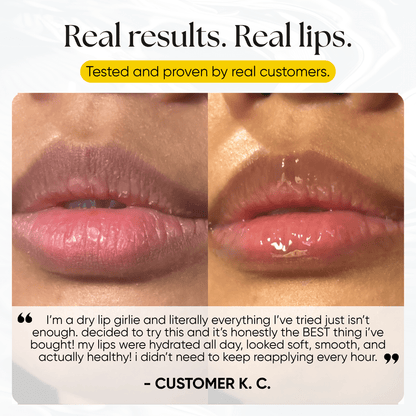 Lip Repair Essence - CHEEKYGLO