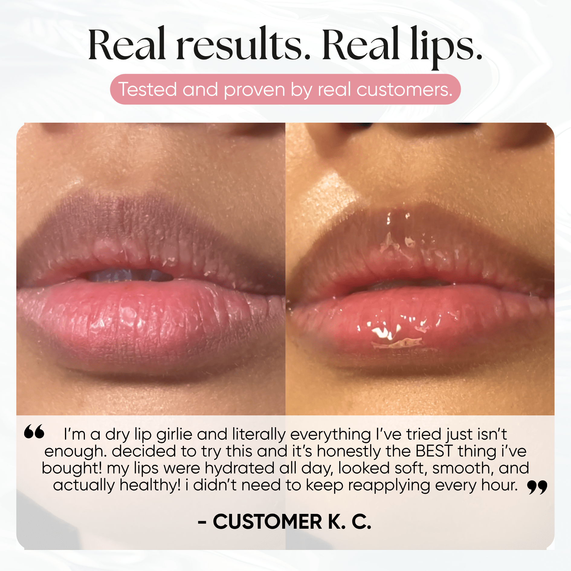 Lip Repair Essence - CHEEKYGLO
