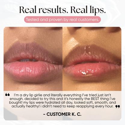 Lip Repair Essence - CHEEKYGLO