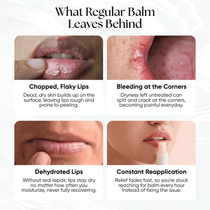 Lip Repair Essence - CHEEKYGLO
