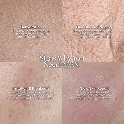 PDRN Plus+ Advanced Collagen Peptide Cream - CHEEKYGLO