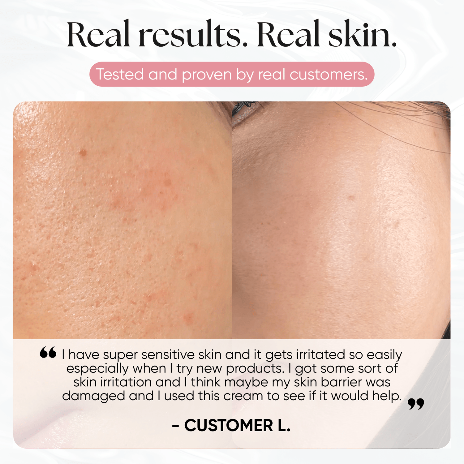 PDRN Plus+ Advanced Collagen Peptide Cream - CHEEKYGLO