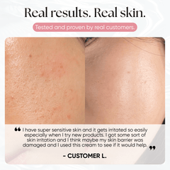 PDRN Plus+ Advanced Collagen Peptide Cream - CHEEKYGLO