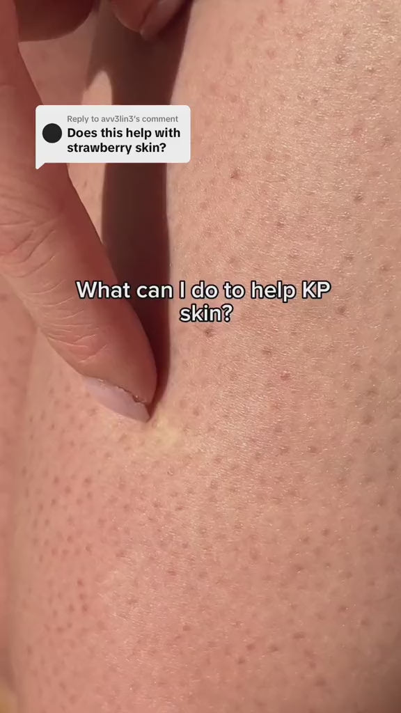 cheekyglo exfoliating glove product development story on how it can help with kp skin