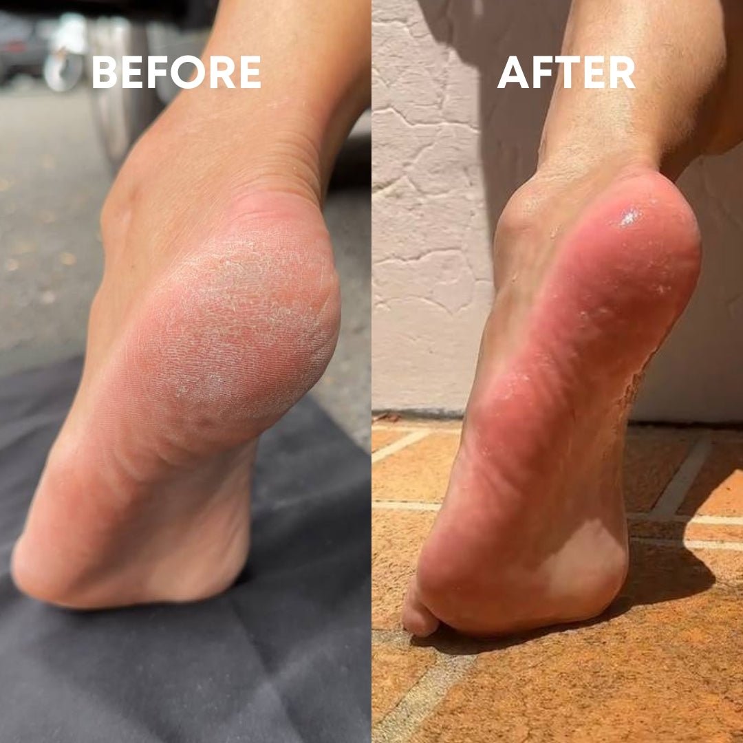 Scrub &amp; Buff Set [MOST LOVED ❤️] - CHEEKYGLO