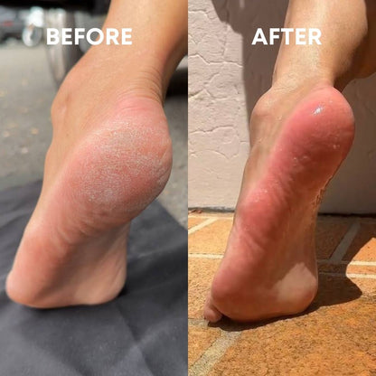 Scrub &amp; Buff Set [MOST LOVED ❤️] - CHEEKYGLO