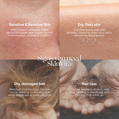 SkinVita Vitamin Beauty Shower Filter