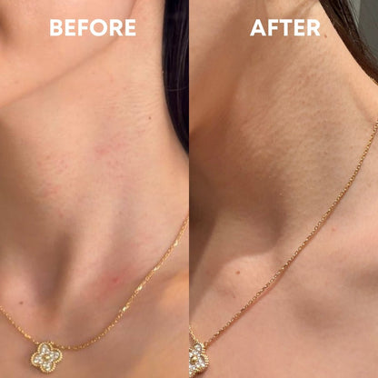 Skin Reset Hypochlorous Spray - CHEEKYGLO