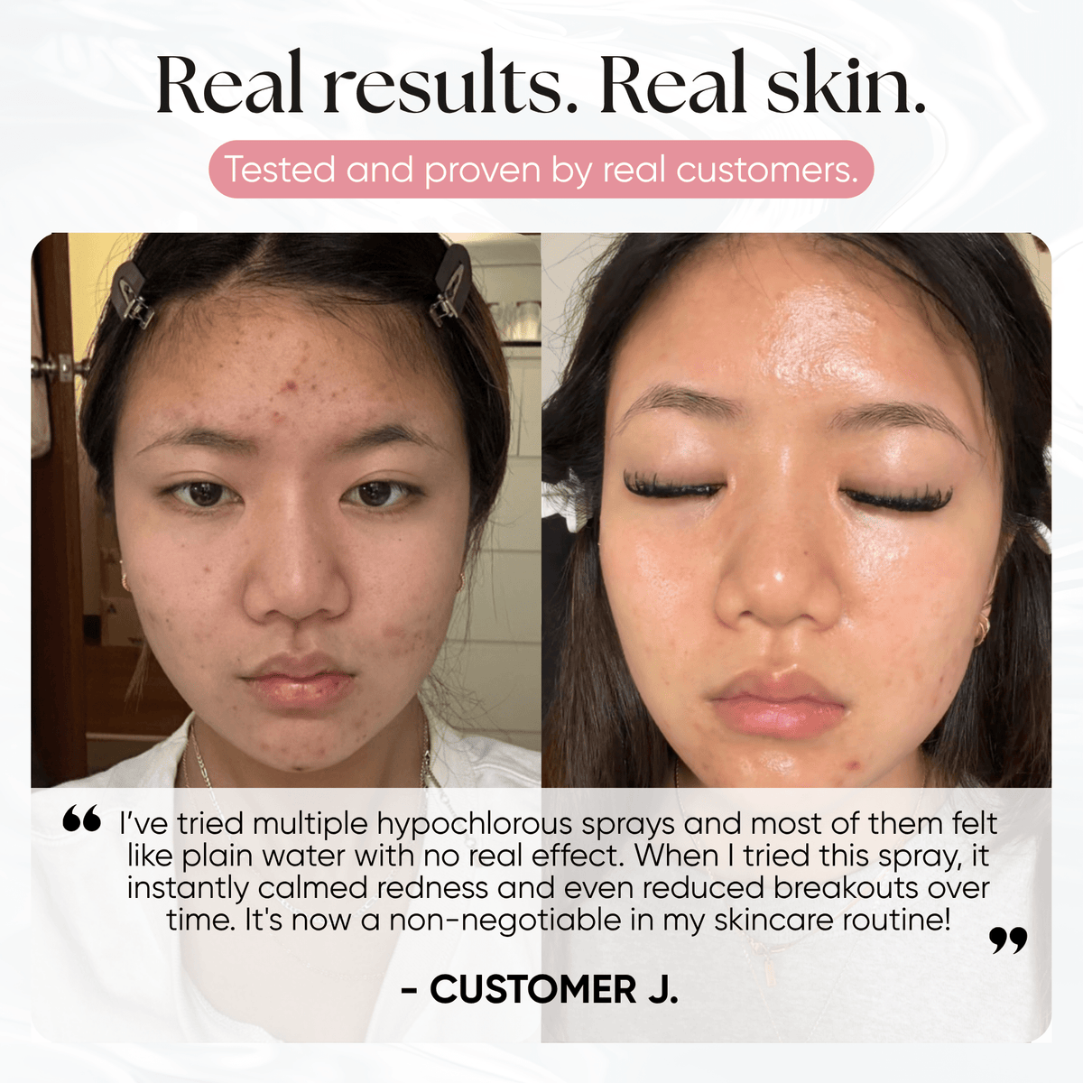 Skin Reset Hypochlorous Spray - CHEEKYGLO