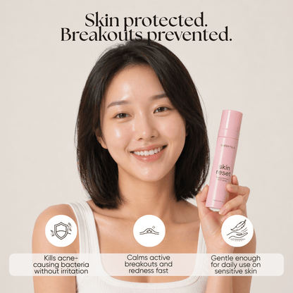 Skin Reset Hypochlorous Spray - CHEEKYGLO
